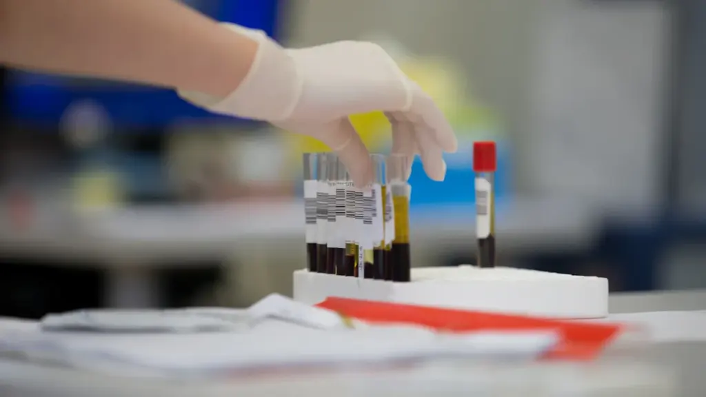 Gant médical manipulant un tube de prélèvement sanguin en laboratoire professionnel.